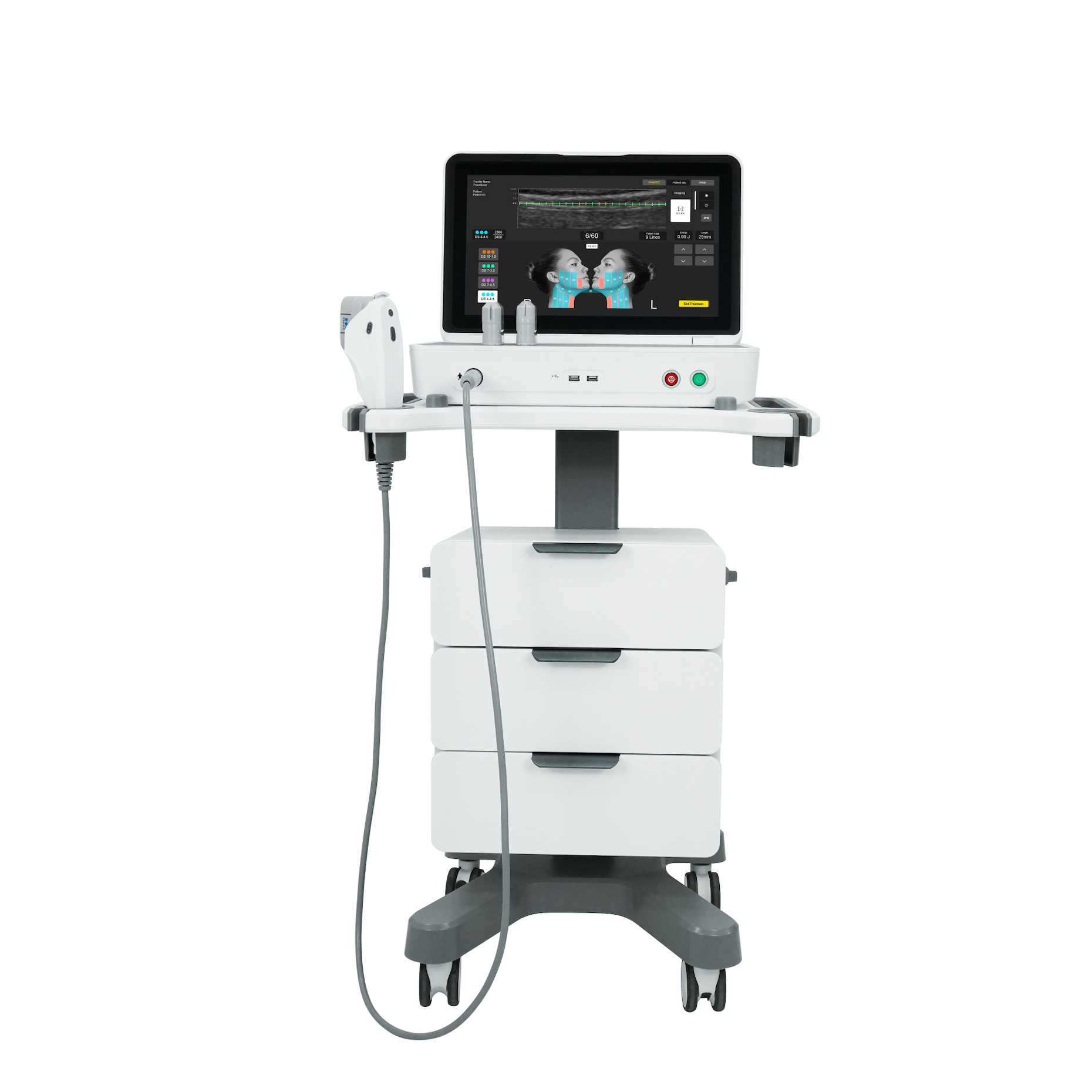 view